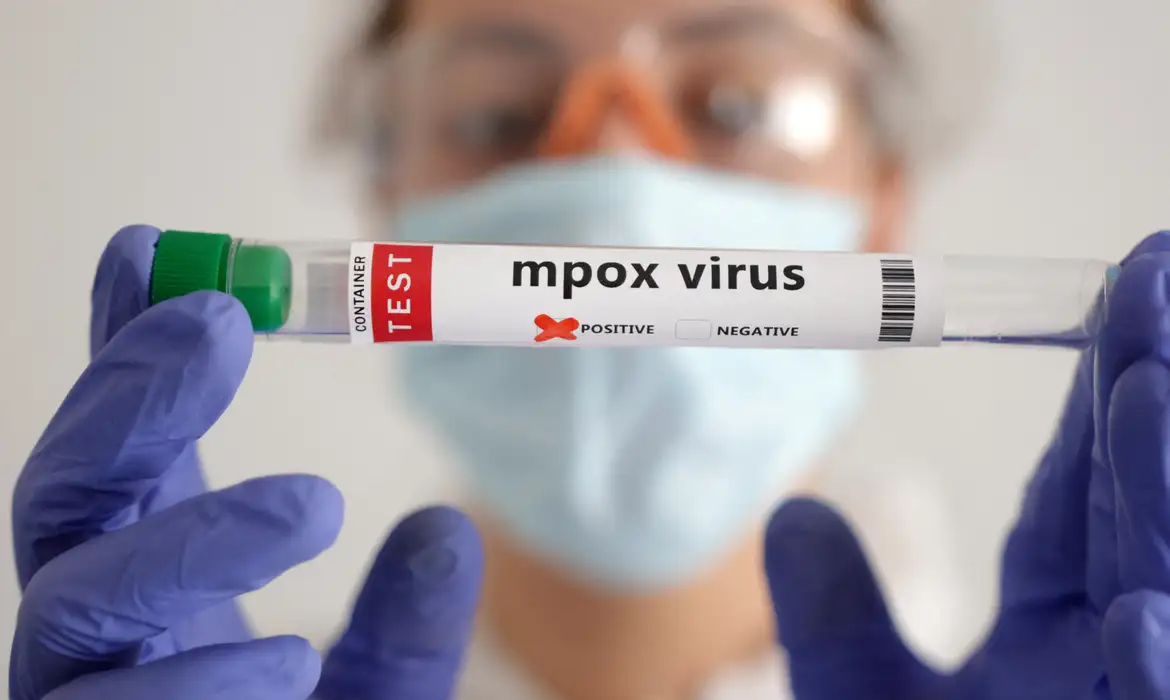 Estados Unidos confirmam primeiro caso de nova variante da mpox